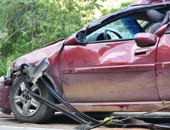 Understanding the Severity of Car Accident Face Injuries