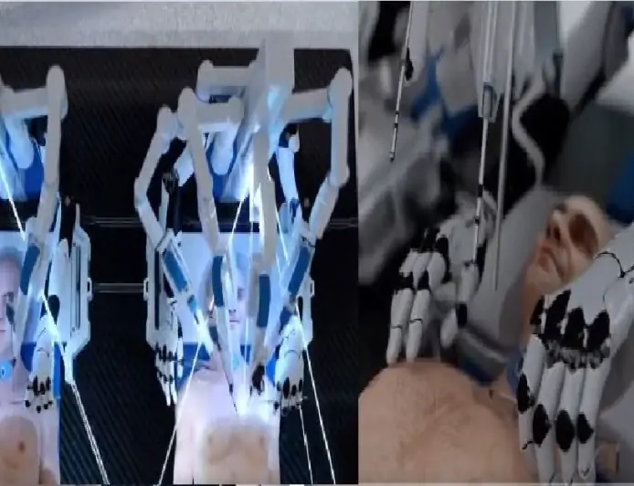 [VIRAL VIDEO] Depicting A Simulation Of A Head Transplant Could Become A Reality In the Future