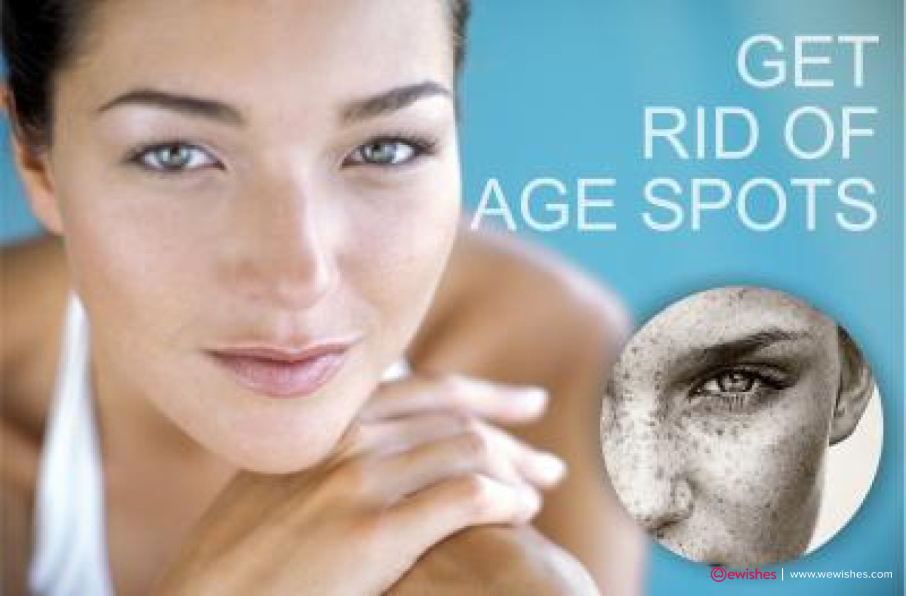 Best Ways To Get Rid Of Age Spots on the Face