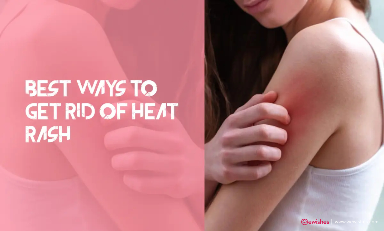 Best Ways To Get Rid Of Heat Rash