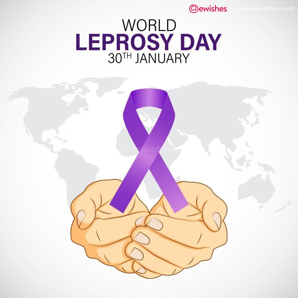 world  leprosy day